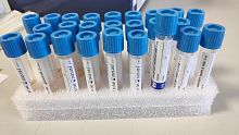 Clinical collection kit MS01430