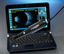 On-platform, tabletop ultrasound system Master-Vufor ophthalmic ultrasound imagingB/W