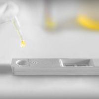 Rapid bladder cancer test UBC®oncologyfor tumor markersurine