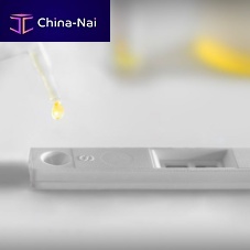 Rapid bladder cancer test UBC®oncologyfor tumor markersurine