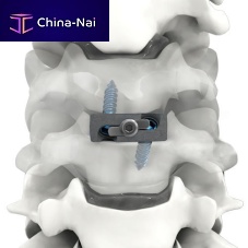 Cervical interbody fusion cage PRO-LINK®anteriortitanium